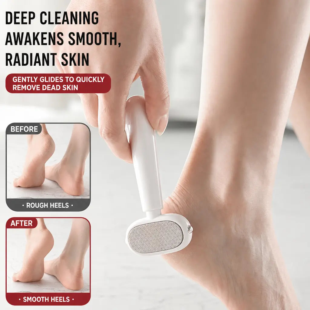 🦶 Smooth Heels Fast ✨ Dual-Sided Foot Callus Remover with Replaceable Stainless Steel Blade
