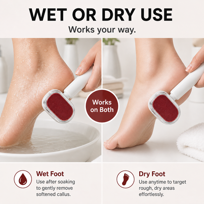 Dual-Sided Foot Callus Remover & Foot File | Wet & Dry