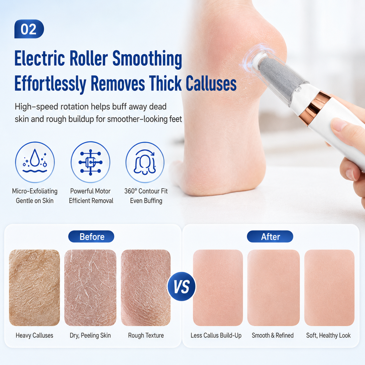 Electric Foot Callus Remover | USB-C Pedicure Tool