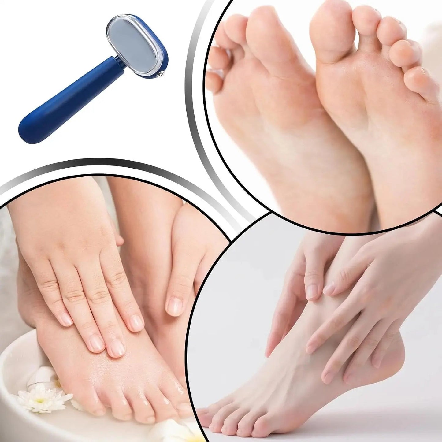 🦶 Smooth Heels Fast ✨ Dual-Sided Foot Callus Remover with Replaceable Stainless Steel Blade
